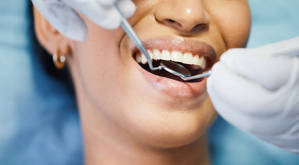 Best Knocked-Out Tooth (Avulsed Tooth) Treatment in Howe, TX